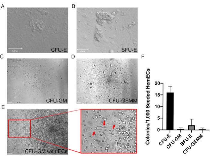 figure-results-4 Colony formation assays; microscopy images CFU types; bar graph of colony counts; stem cell analysis.