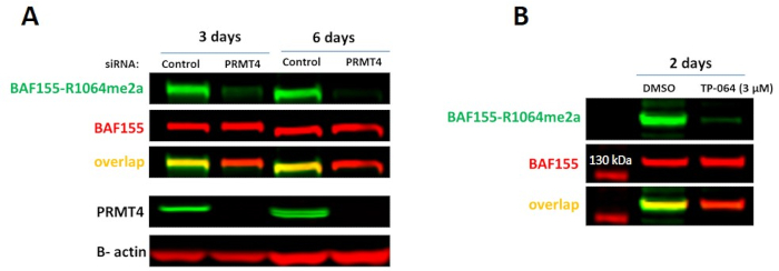figure-results-3 BAF155-R1064me2a analysis; siRNA, PRMT4 impact; Western blot results, protein expression study.