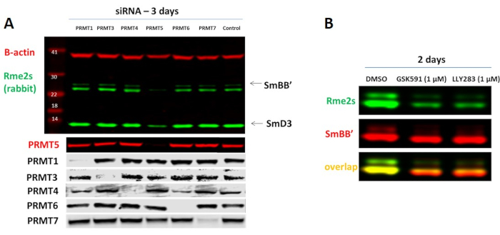 figure-results-4 siRNA analysis; Western blot; PRMT inhibition; protein expression levels; fluorescence imaging analysis.