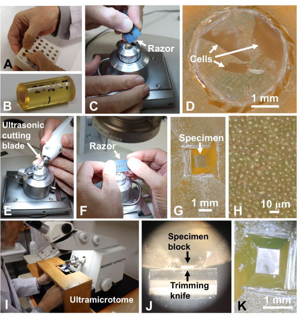 Ultramicrotome process with razor, ultrasonic blade, cells, specimen, microscopy, sectioning results.