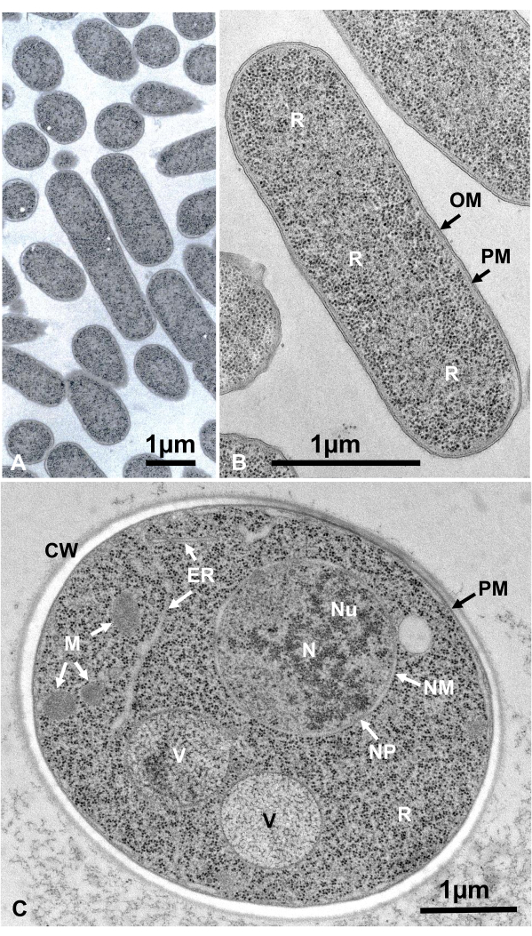 Bacterial cell structure, electron micrograph; highlights membranes, organelles, nucleoid in prokaryote.