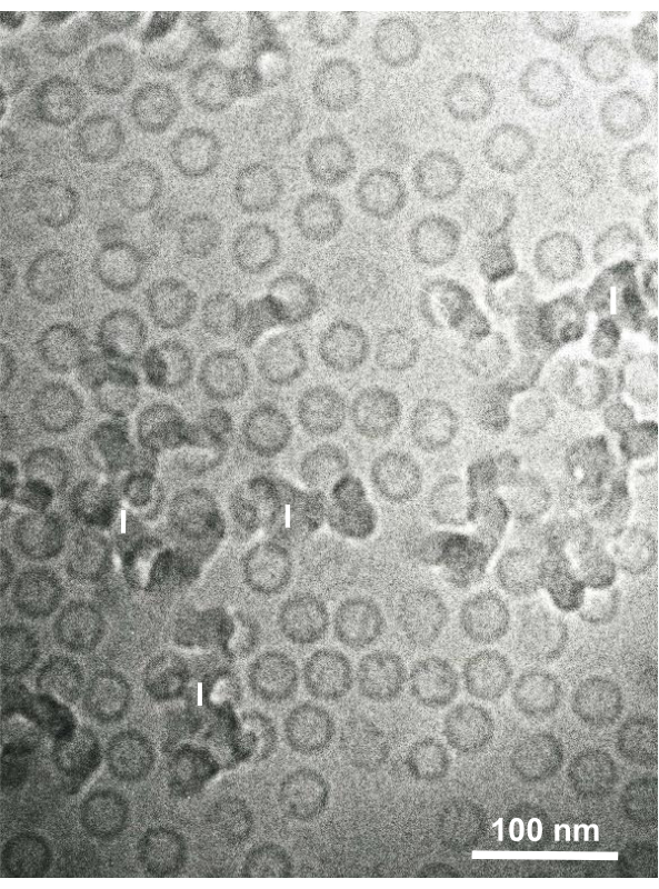 Transmission electron microscopy image, virus particles, 100 nm scale, high-resolution analysis.