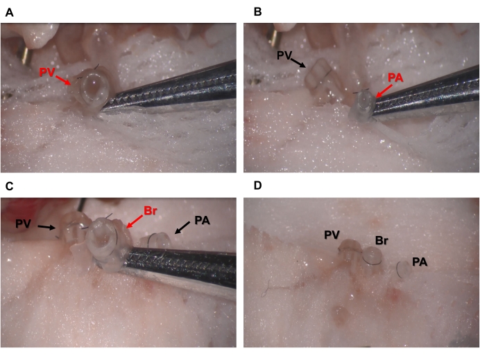 figure-results-4 Microdissection process showing pulmonary veins (PV), pulmonary arteries (PA), bronchus (Br) in tissue.