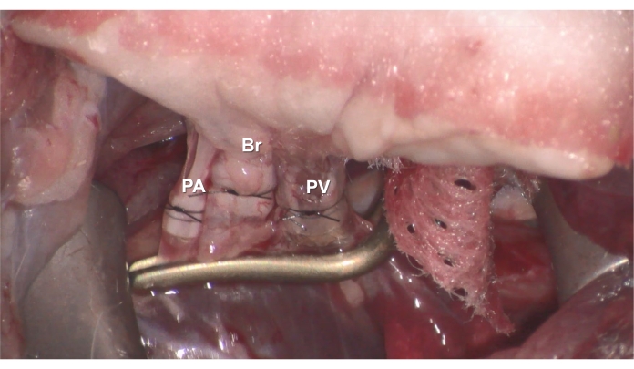 figure-results-6 Anatomical dissection diagram showing PA, Br, PV labeled, highlighting vascular structures.