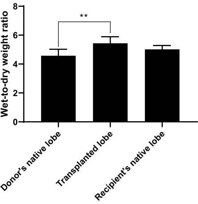 figure-results-11 Bar chart showing wet-to-dry weight ratio comparison: donor, transplanted, recipient lung lobes.