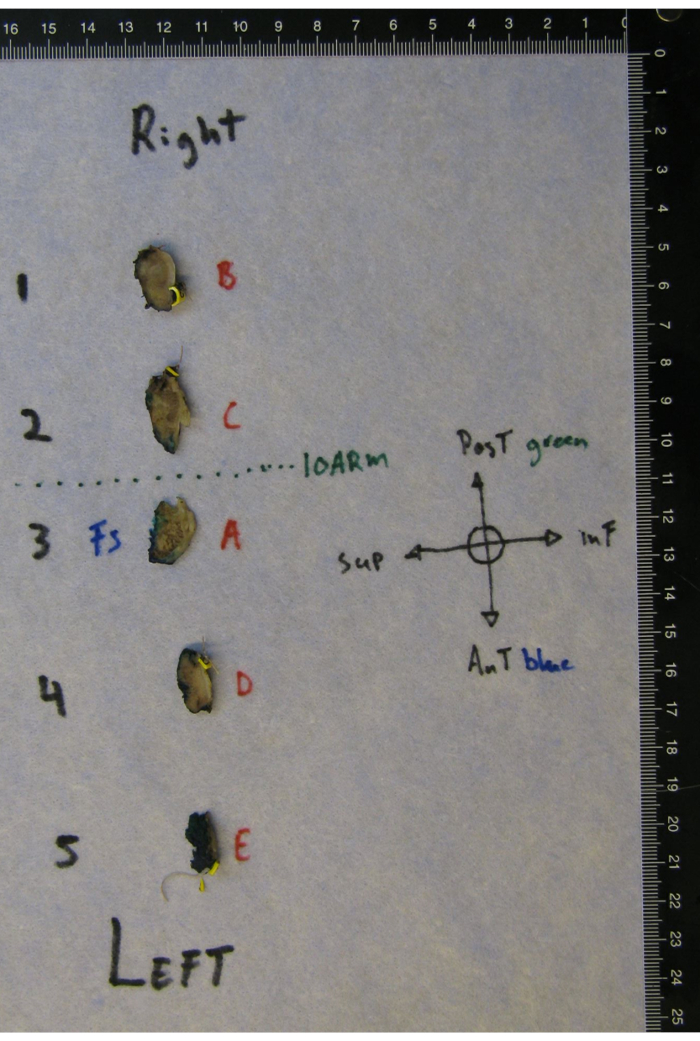 figure-protocol-6 Tissue orientation diagram; labeled coordinates and sections for anatomical study.