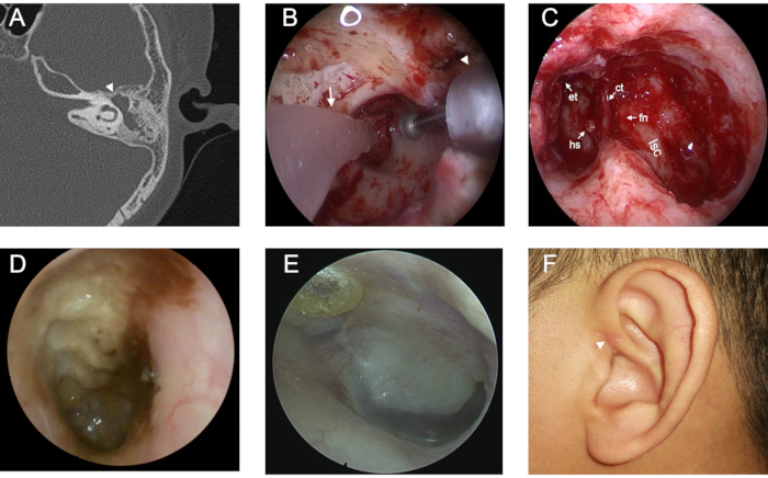 figure-results-2 Ear examination diagrams and images; procedures and conditions assessment in otolaryngology study.