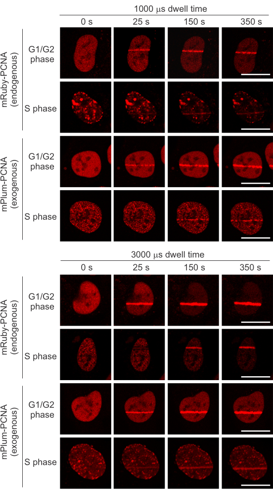 Fluorescence microscopy images; mRuby-PCNA, mPlum-PCNA; cell cycle, G1/G2, S phase, dwell time.