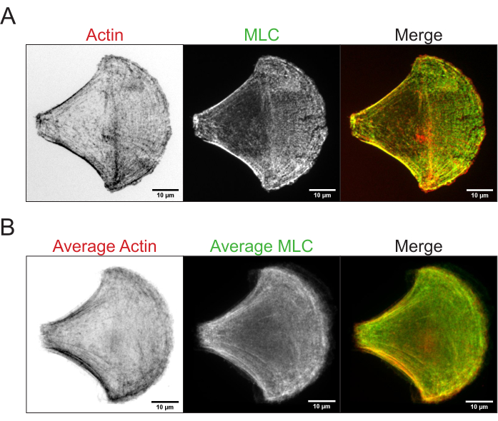 Fluorescence microscopy diagram; actin, MLC protein distribution and merge; cellular study.