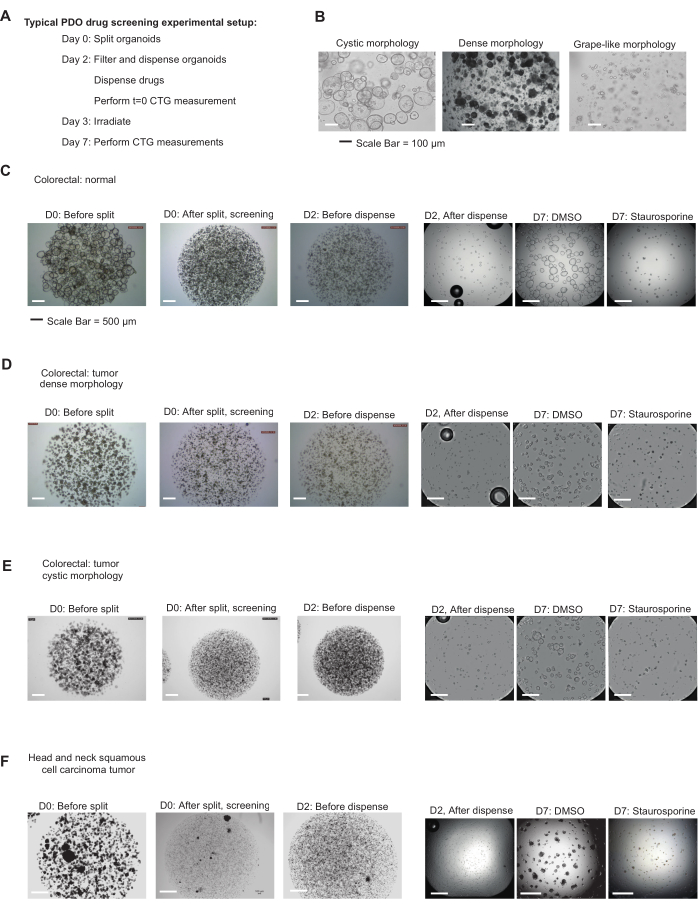 PDO drug screening diagram; organoid morphology; colorectal tumor analysis; CTG measurement setup.