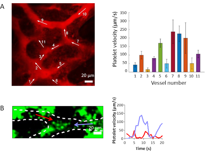 figure-results-4 Platelet velocity analysis; fluorescence images, velocity graph, microvascular flow study.