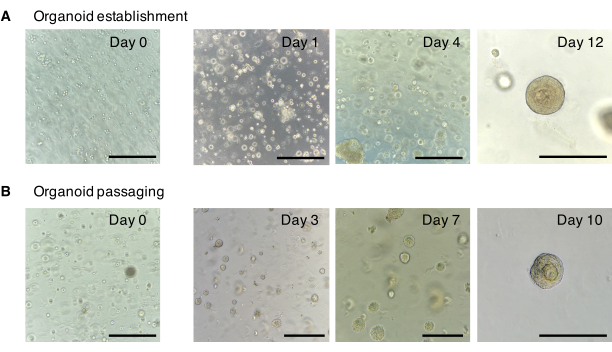 Organoid growth phases; microscopy images showing establishment and passaging over time.