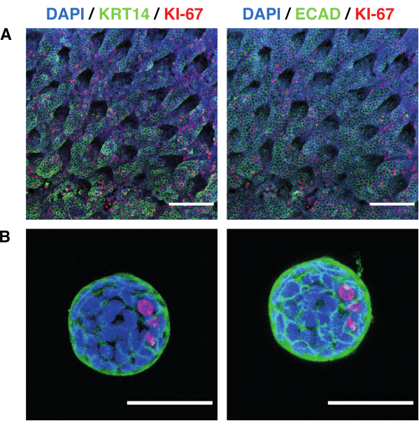 Immunofluorescence microscopy, DAPI/KRT14/KI-67, DAPI/ECAD/KI-67, cellular structure analysis.