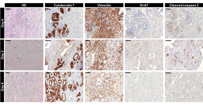 组织染色的组织学分析：HE、细胞角蛋白7、波形蛋白、Ki-67、Cleaved Caspase 3。