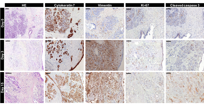 组织学比较；HE染色；细胞角蛋白7、波形蛋白、Ki-67、活化型caspase 3标志物。