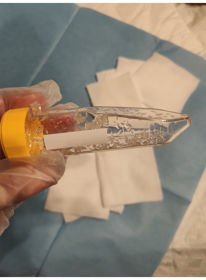Laboratory centrifuge tube with microbial culture sample, used for protein isolation analysis.