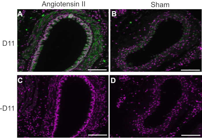 figure-results-1 Angiotensin II effect on vessel walls; fluorescent microscopy; cellular response comparison; experimental.