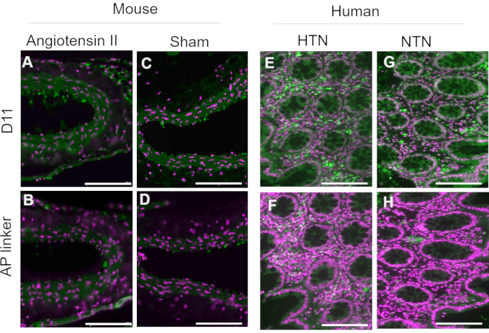 figure-results-3 Mouse and human tissue sections with fluorescence microscopy for Angiotensin II and HTN analysis.