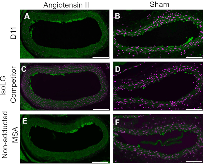 figure-results-4 Histological comparison chart of vascular tissues with angiotensin II treatment; fluorescence staining.