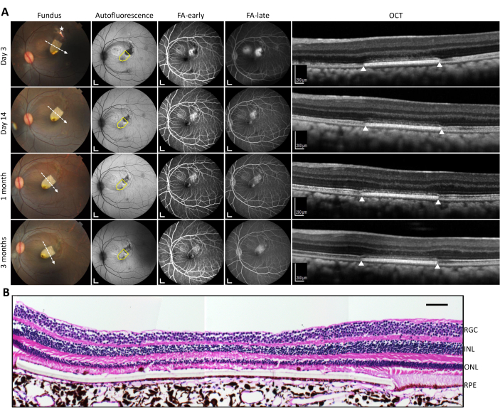 Retinal imaging and histology; fundus, autofluorescence, OCT, and tissue section analysis.