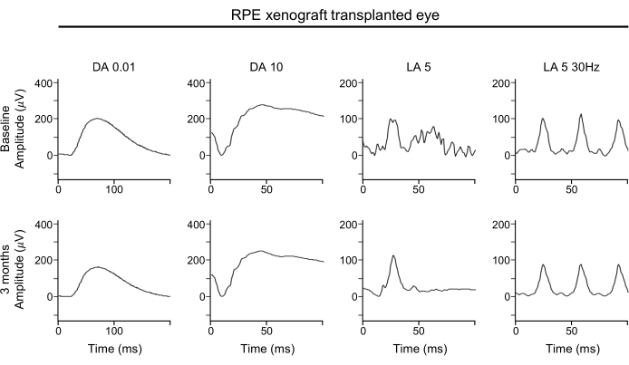 RPE xenograft eye response, electrophysiology graphs, amplitude vs. time, DA and LA conditions.