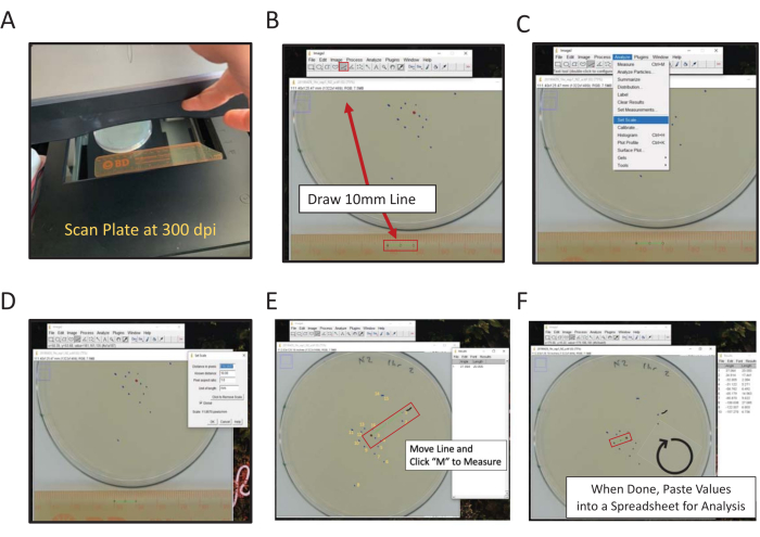 figure-results-2 Petri dish analysis: start scan, draw line, select, measure, document for data analysis.