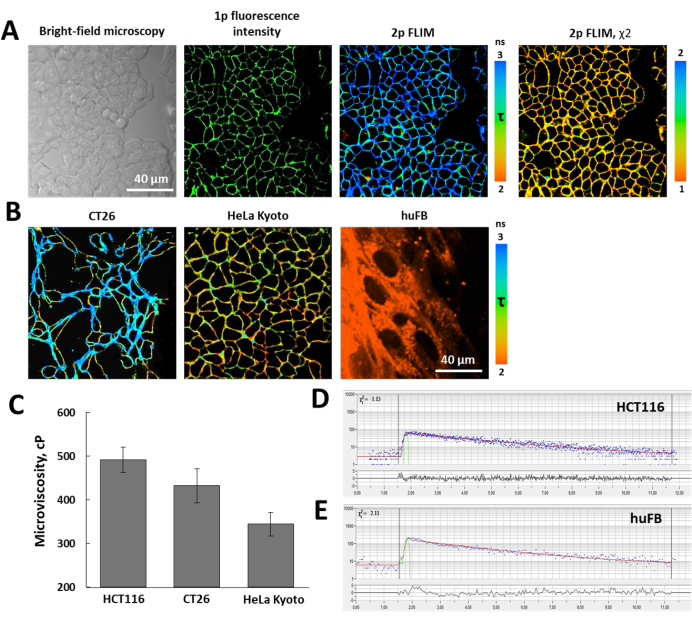 Video: Probing Metabolism and Viscosity of Cancer Cells using ...