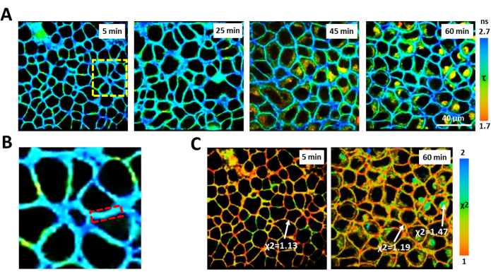 Video: Probing Metabolism and Viscosity of Cancer Cells using ...