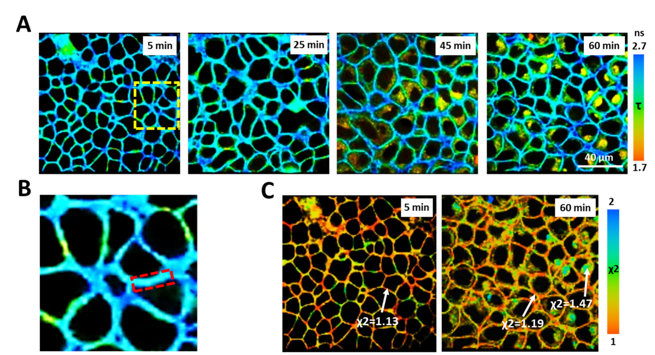 Video: Probing Metabolism and Viscosity of Cancer Cells using ...