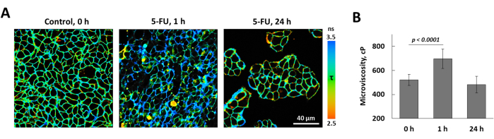 Video: Probing Metabolism and Viscosity of Cancer Cells using ...