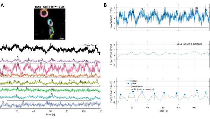 Microscopy image and time-series graph showing signal filtering; analysis of ROI fluorescence data.