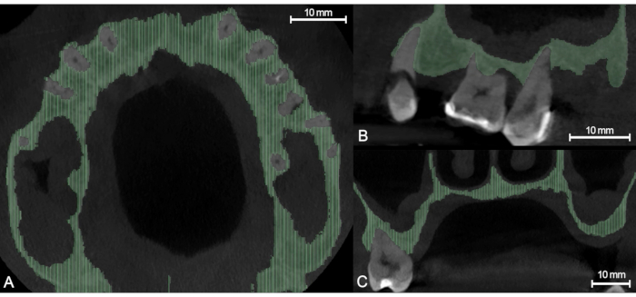 figure-protocol-2 CT scan images showing jawbone structure analysis; includes cross-sectional views, dental imaging.