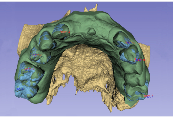 figure-protocol-4 Dental 3D scan, jaw reconstruction process, diagram for anatomical study, orthodontic analysis.