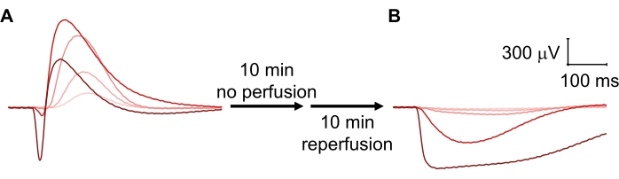 Electrophysiology waveform analysis, diagram; perfusion-reperfusion effects; 300 µV, 100 ms scale.