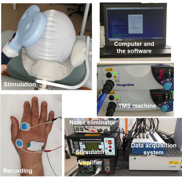 figure-results-1 Transcranial magnetic stimulation setup: devices, electrodes, software interface for brain research.