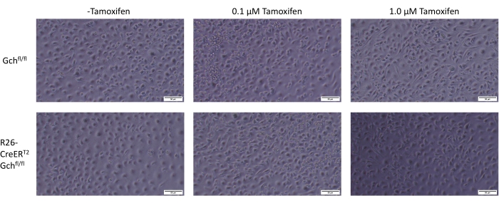 Cell response to tamoxifen in vitro; light microscopy images; varying tamoxifen concentrations.