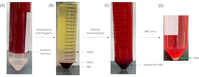 Blood component separation diagram using Lymphoprep centrifugation, dextran sedimentation, RBC lysis.