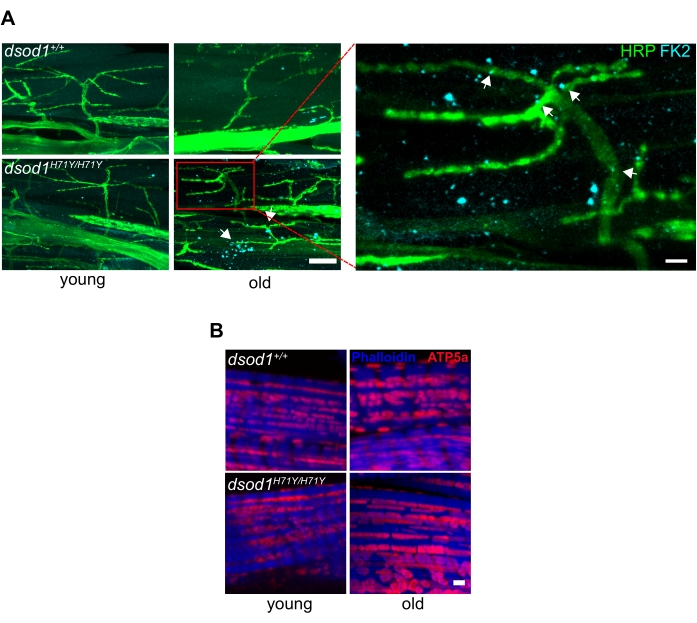 figure-results-4 Microscopy images comparing dsod1 mutant muscle degeneration in young vs. old; fluorescent staining.