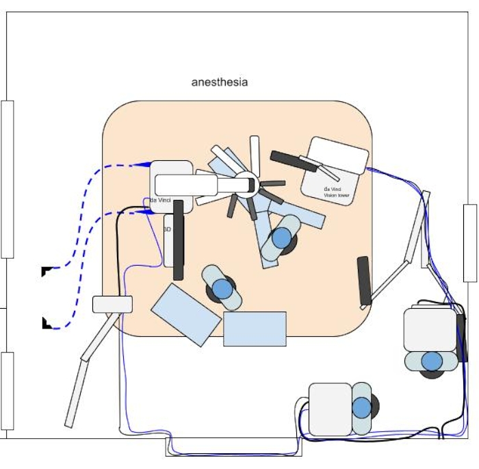 Robotic surgery setup diagram, Da Vinci system layout, anesthesia positioning.
