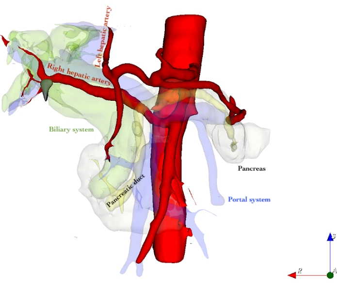 Hepatic anatomy diagram; right hepatic artery, biliary and portal systems, pancreas, pancreatic duct.