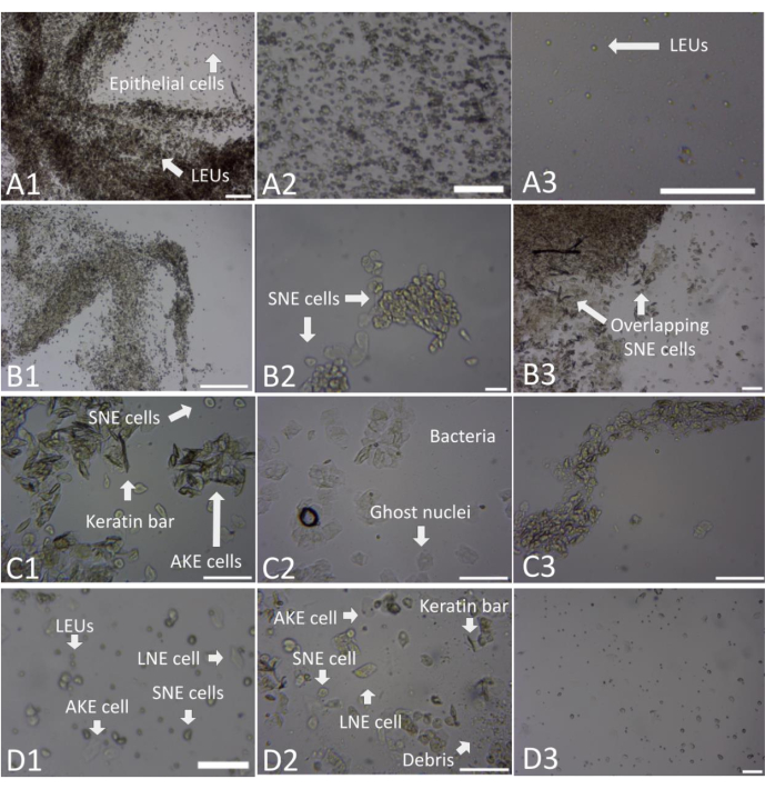 figure-results-5 Imágenes de microscopio que muestran células epiteliales, células SNE, barras de queratina, bacterias en análisis celular.