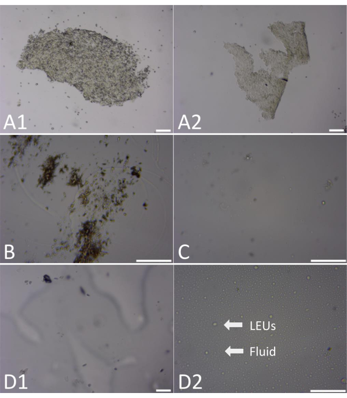 figure-results-7 Imágenes de microscopio de diversas preparaciones celulares; etiquetado como A1, A2, B, C, D1, D2; análisis biológicos.
