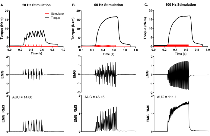 Muscle stimulation EMG graphs at 20, 60, 100 Hz; torque vs time analysis in electrophysiology study.
