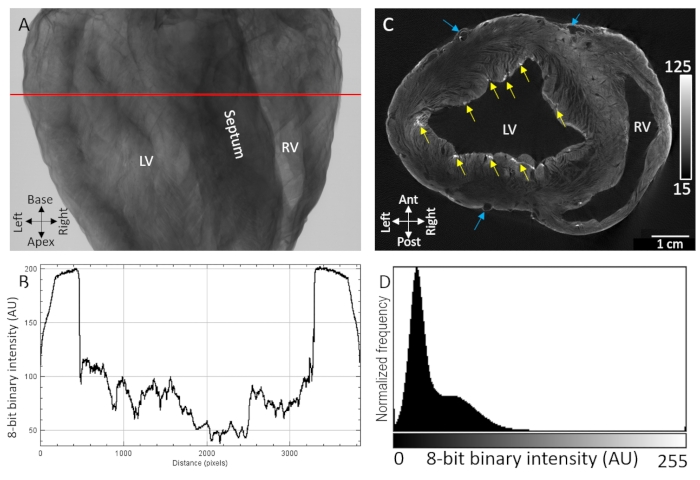 figure-results-1 Heart anatomy cross-section diagram with LV, RV labels, binary intensity graph, and histogram data analysis.