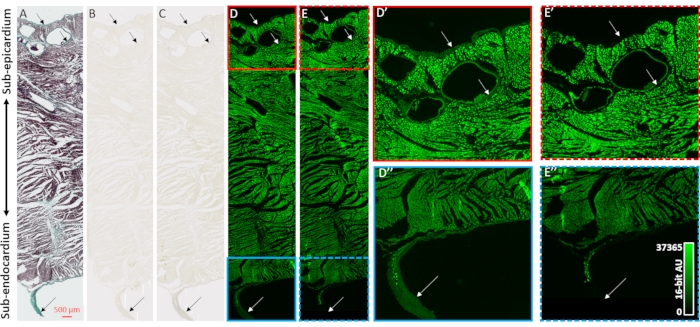 figure-results-2 Heart tissue analysis with histological stain and fluorescence microscopy; sub-epicardium to sub-endocardium.