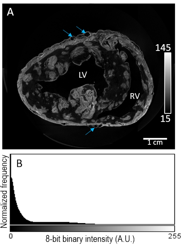 figure-results-3 Cardiovascular MRI and histogram analysis; diagram shows cross-sectional heart imaging and intensity histogram.