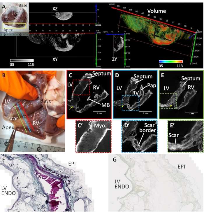 figure-results-4 Cardiac muscle analysis with cross-sections, scar visualization; diagram of heart anatomy, microscopy.