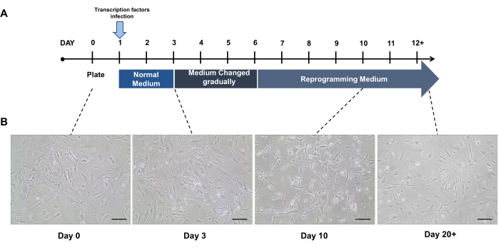 Video: Direct Reprogramming of Mouse Fibroblasts into Melanocytes