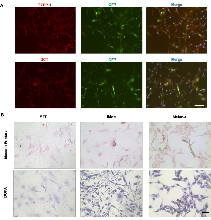 figure-results-4 Fluorescence microscopy of TYRP-1/DCT with GFP, Masson-Fontana/DOPA stain in MEF, iMels, Melan-a.