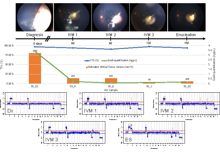 figure-results-4 Retinal tumor progression, treatment timeline, quantitative data, photomicrographs, growth analysis chart.